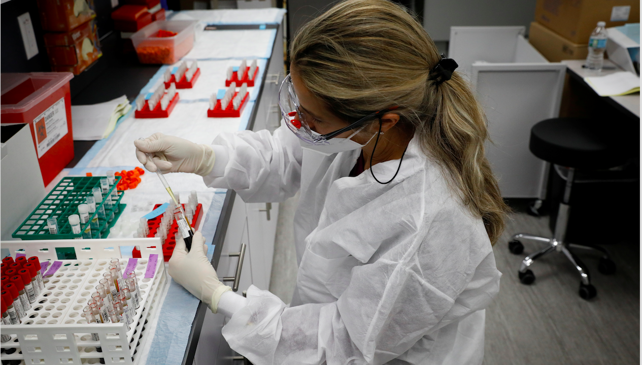 Covid-19: la Suisse teste le candidat vaccin de la biotech Moderna dirigée par le Français Stéphane Bancel