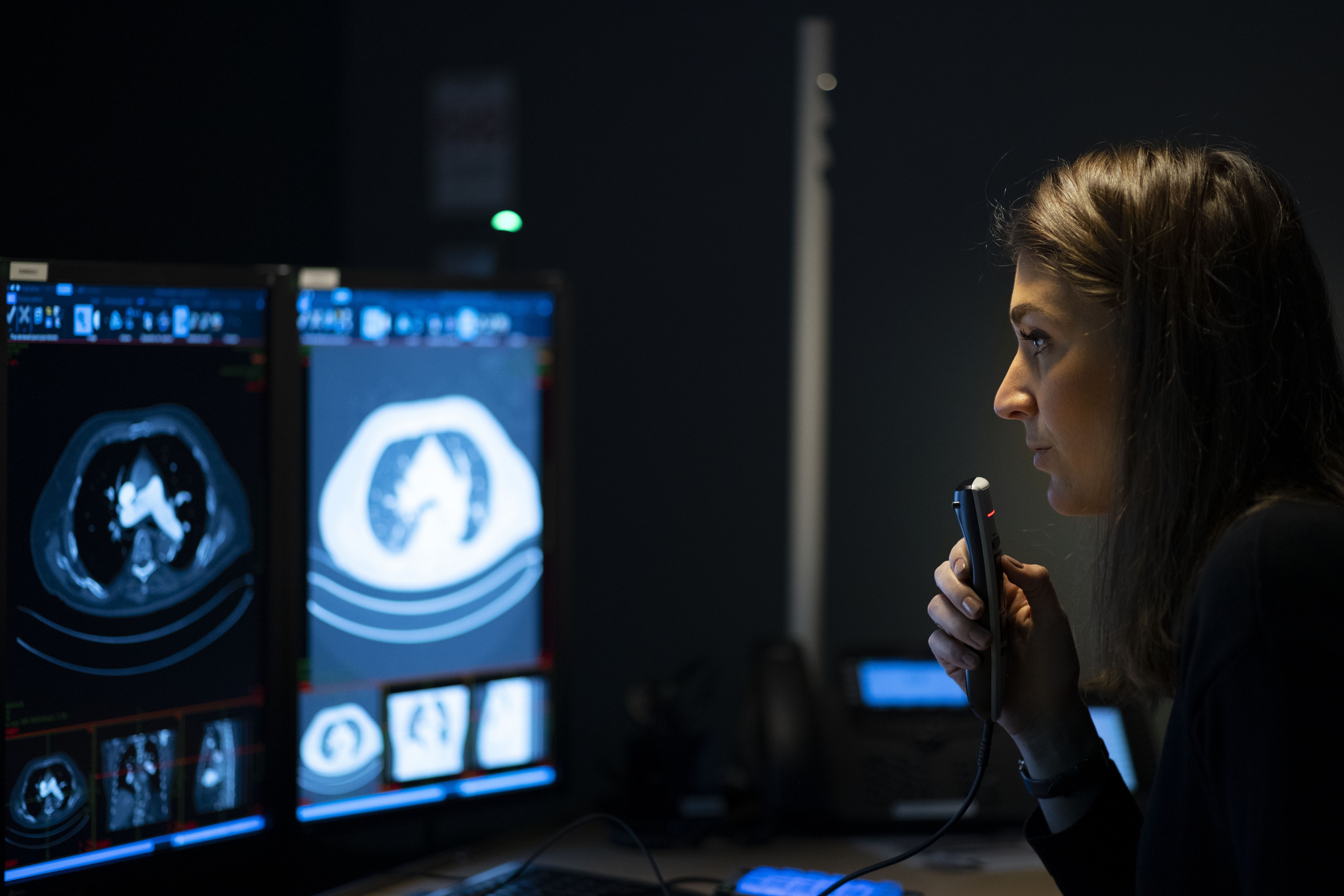 Téléradiologie : le lyonnais Imadis fait le pari de l'IA pour améliorer l'efficacité de l'offre de soins