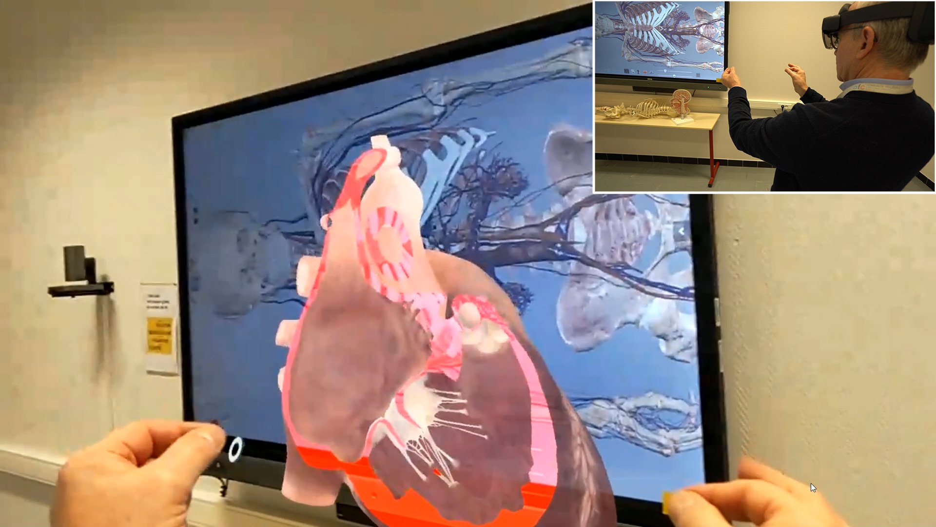 Des étudiants cardiologues formés grâce à l'IA et la réalité augmentée