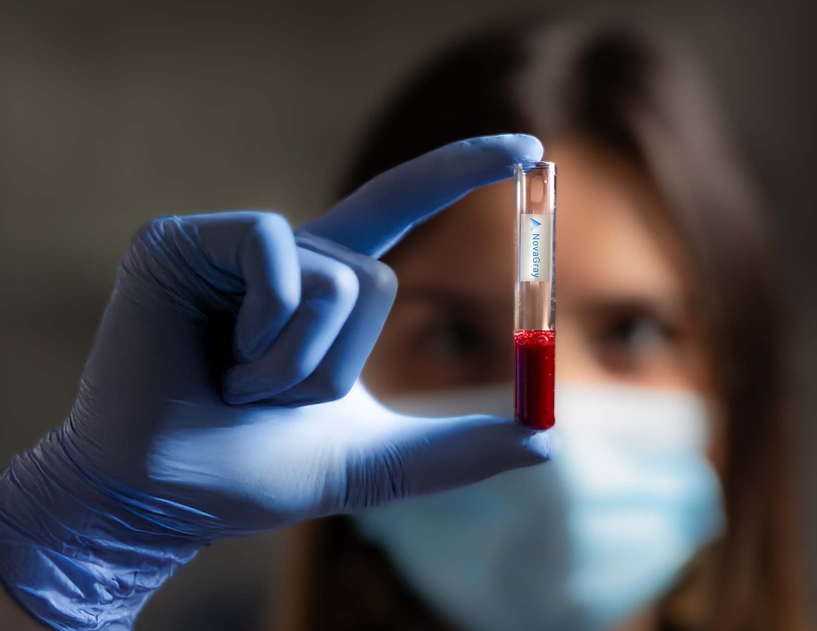 Cancer : un test sanguin pour adapter la radiothérapie aux patients