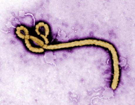 Premier décès lié à la fièvre Ebola au Mali