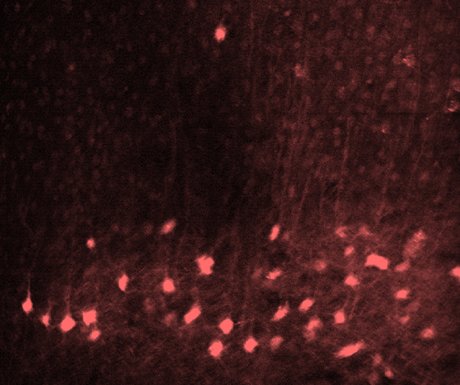 Spark Lasers neurones