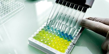 Le kit de diagnostic conçu par IDvet à Montpellier permet la détection des anticorps contre le SARS-CoV-2