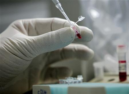 SEIZE CAS DE GRIPPE A(H1N1) DIAGNOSTIQUÉS DANS UN COLLÈGE DE TOULOUSE