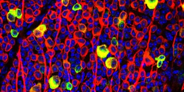 Neurones de la rétine interne dont la survie est stimulée  par une  injection de Neurovita 
(le corps cellulaire de ces neurones apparait  en jaune).