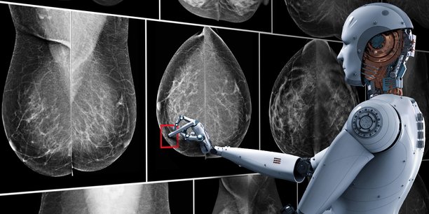 IA et ergonomie : les deux piliers de Therapixel pour améliorer le dépistage du cancer du sein