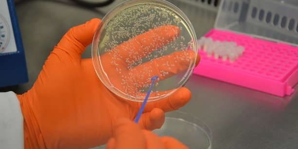 Novolyze utilise des bactéries à l'échelle industrielle afin de vérifier la capacité des procédés industriels à éliminer les pathogènes en optimisant au plus juste les paramètres de traitement pour préserver la qualité du produit.