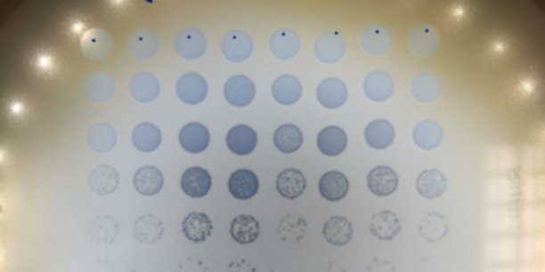 Et si le prochain traitement pour remplacer certains antibiotiques dans le cadre des infections ostéo-articulaires était conçu à base d'un cocktail de phages ? Ce phagogramme permet d'observer des plages de lyse (petits trous) induits par les phages dans un échantillon de bactéries.