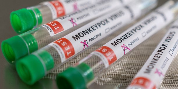 L'oms dit que la variole du singe reste maitrisable, confirme 131 cas hors afrique[reuters.com]