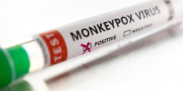 La variole du singe peut etre maitrisee par des actions rapides, dit l'oms[reuters.com]
