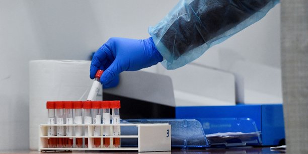 Avant le 1er mars 2023, les tests RT-PCR et antigéniques étaient exceptionnellement pris en charge à 100% par l'assurance maladie.