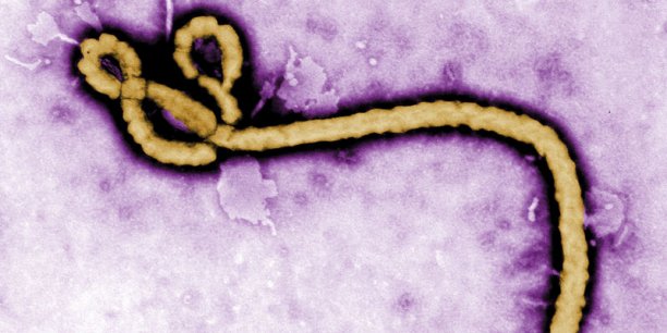 Tests très prometteurs sur le singe du sérum ZMapp contre Ebola[reuters.com]