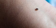 La paranoïa autour de ces petits insectes parasites d'à peine quelques millimètres s'est répandue en France à l'automne dernier.