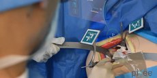 Première mondiale à Strasbourg, à la clinique de l'Orangerie, en août 2023, pour une intervention sur l'épaule, avec la technologie Pixee Medical.