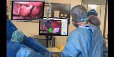 D'ici 2030, Surgar vise 100.000 patients opérés avec son dispositif, afin d'augmenter le nombre de chirurgies mini-invasives réalisées sur trois organes ciblés : l'utérus, le foie et le rein.