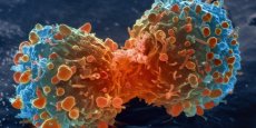 Le nouveau traitement de Novartis contre la leucémie aiguë lymphoblastique coûte 475.000 dollars par patient. Il faudra attendre de nombreuses années avant de voir arriver un traitement reproduisant ses effets, et permettant de faire baisser la note radicalement.