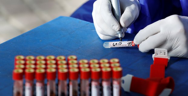 Coronavirus: les tests pcr entierement rembourses en france