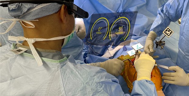 Un chirurgien américain opérant avec les lunettes augmentées Pixee Medical