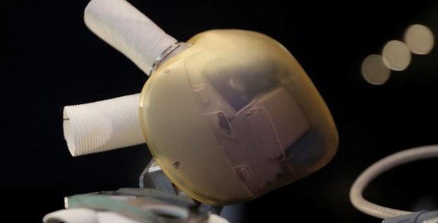 Carmat: implantation d'un coeur artificiel en republique tchcque