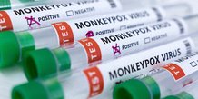 Variole du singe: l'ue obtient des doses supplementaires du vaccin de bavarian nordic